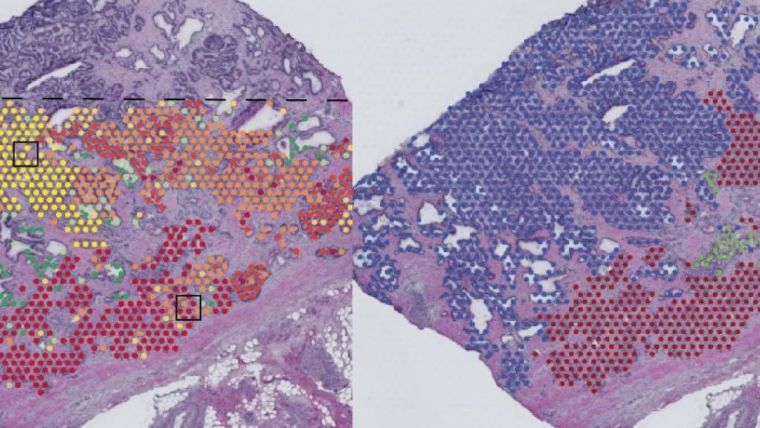 Representation of tissue samples