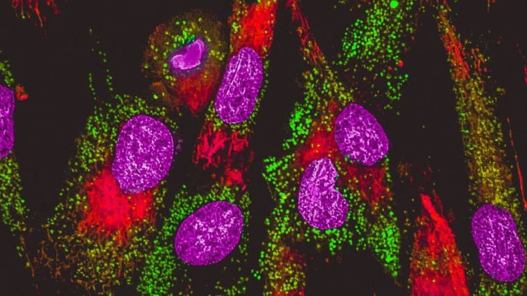 Microscopy image of mitochondria